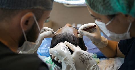 De Verschillende Stappen Van Haartransplantatie